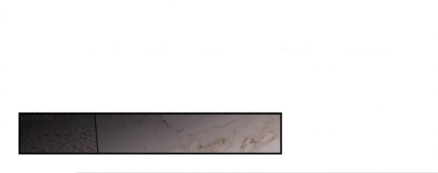 Placebo - Chapter 15 manhwa