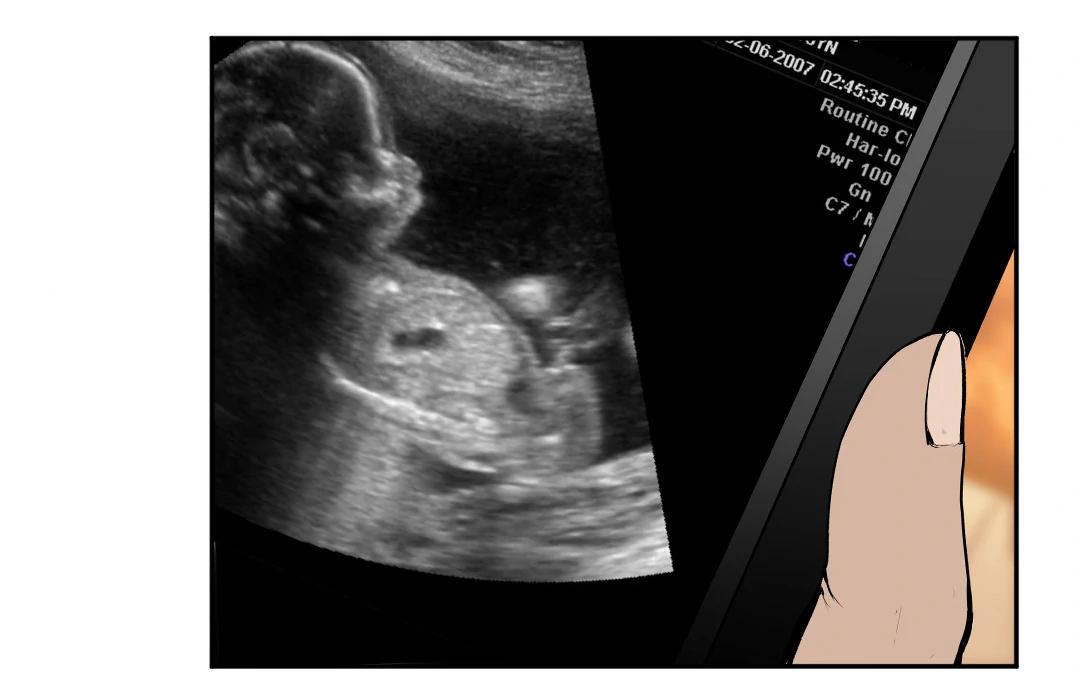 Even Trash Was Once New (MGS) - Chapter 1 manhwa